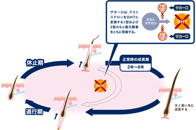 AGAは進行性なので、早めのケアが大切です。